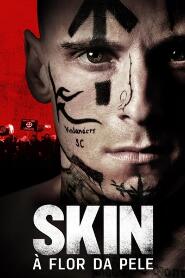 Assistir Skin: À Flor da Pele online