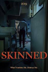 Assistir Skinned online