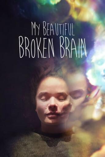 Assistir My Beautiful Broken Brain online